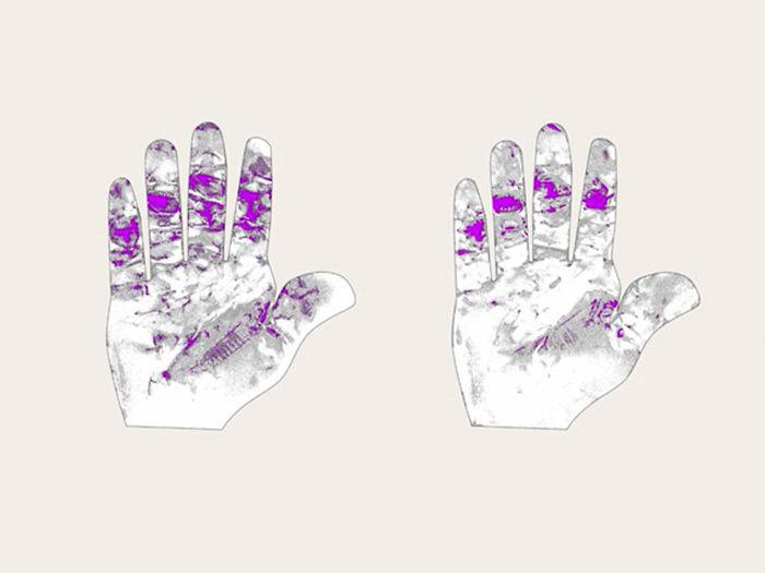 Two illustrations of a hand showing different zones of hand fatigue, highlighted in lilac color